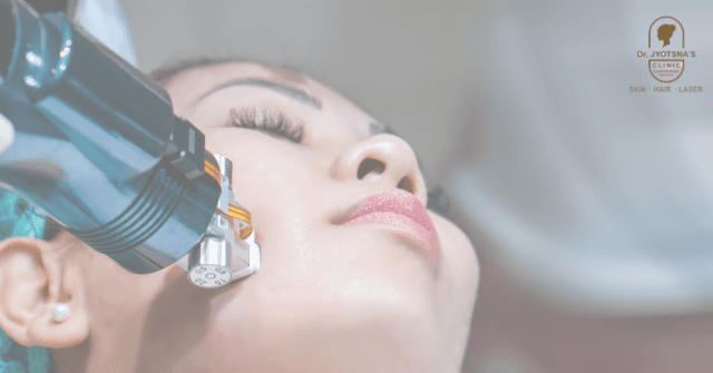 HIFU Face Treatment